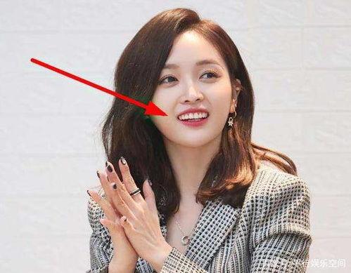 300万假牙明星,揭秘娱乐圈的美丽秘密